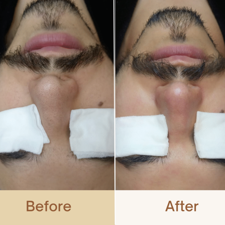 before_after men